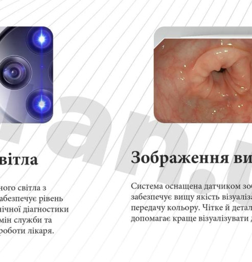 Ендоскопічна стійка для гастроскопії та колоноскопії